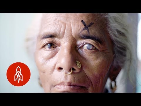 Meet the Surgeon Helping the Blind See Again