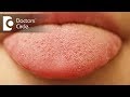 What causes small red patches on tongue? - Dr. Sana Taher