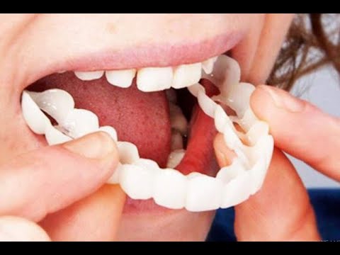 Накладные зубы