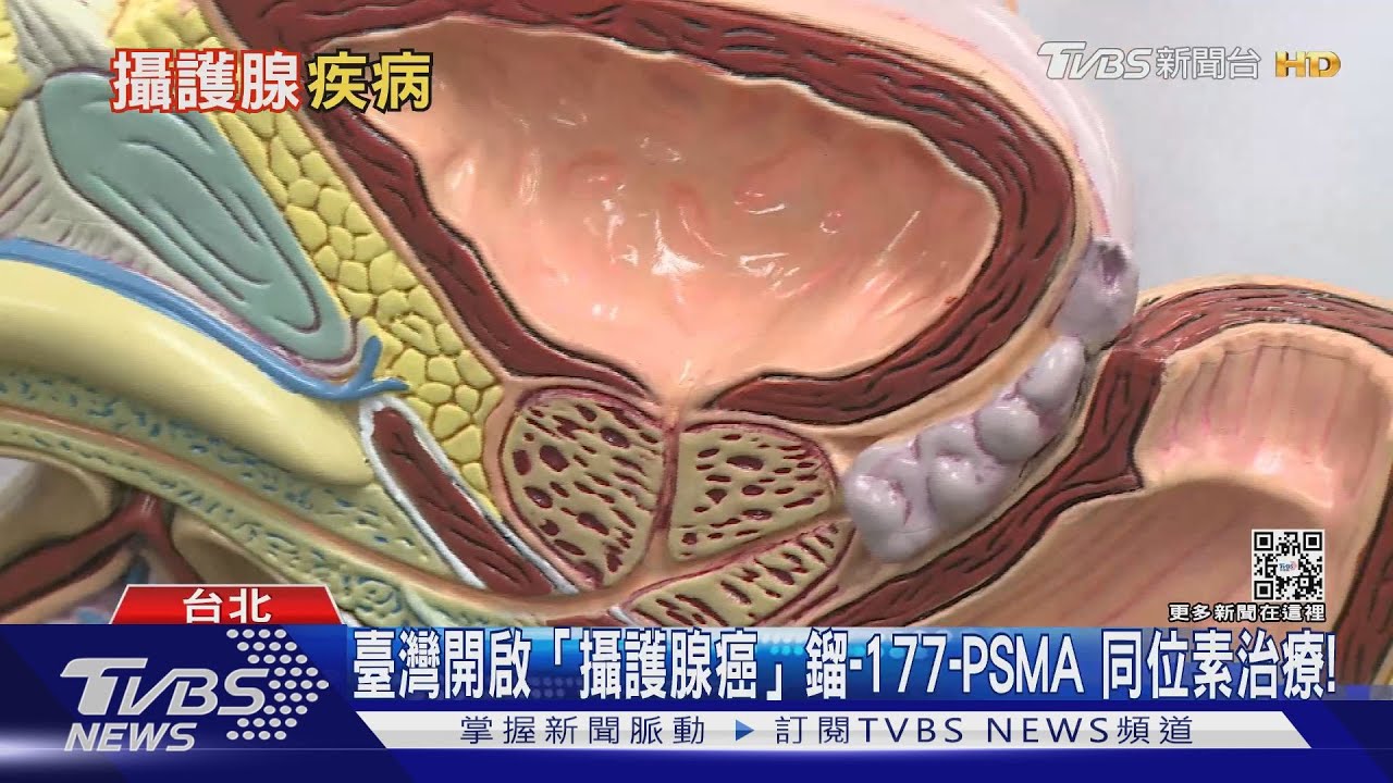 罹「這個癌」初期症狀不明顯 發現時已中晚期!醫:勿輕忽