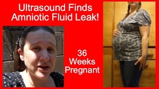 Ultrasound Finds AMNIOTIC FLUID LEAK | 36 WEEKS PREGNANT |