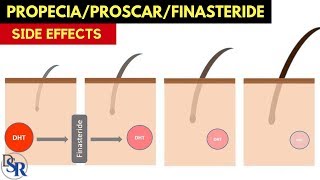 👉 Propecia/Proscar (finasteride) Side Effects - The Secret To Fixing Them - By Dr Sam Robbins