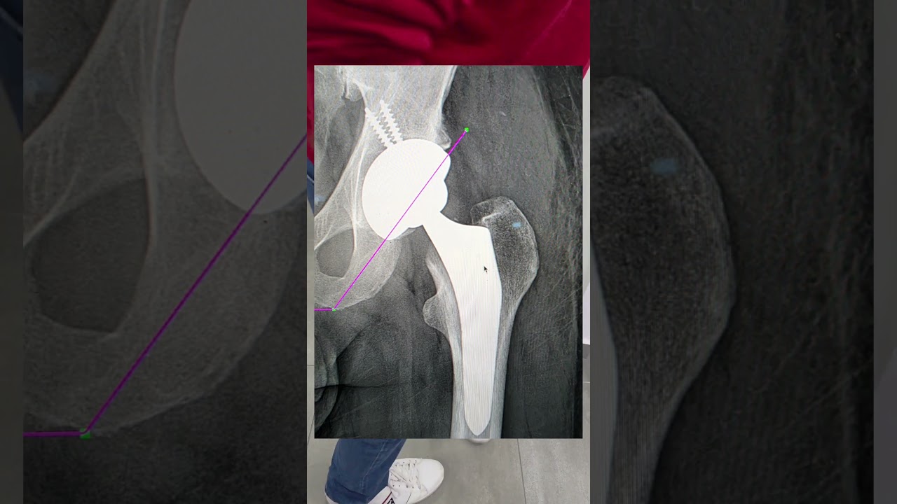 Jorge Luis Martínez Navarro-19