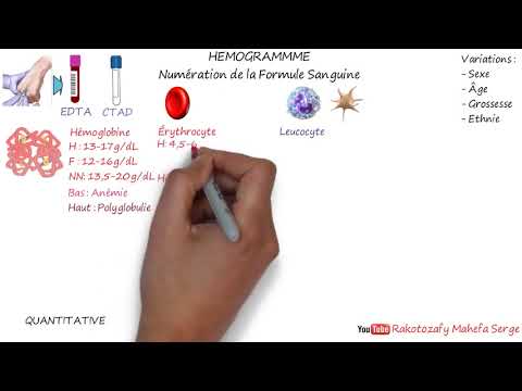 l'interprétation d'un NFS