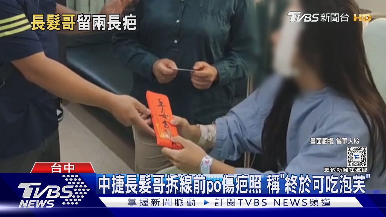 中捷長髮哥po傷疤照!自比「肌肉魔法使」兩條線 稱「終於可吃泡芙」