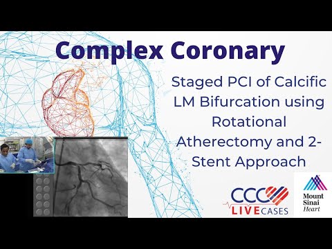 Staged PCI of Calcific LM Bifurcation using Rotational Atherectomy & 2-Stent Tech. March 2016 Video