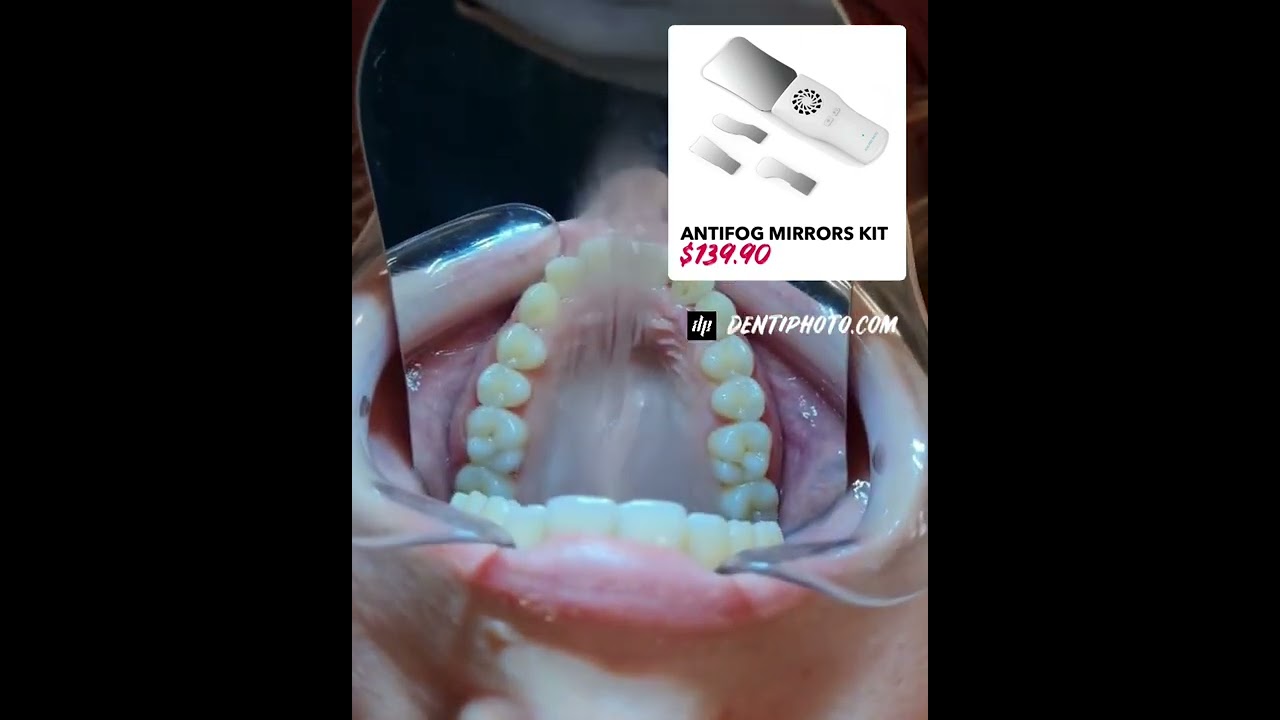 Fog mirror for dental intraoral photography