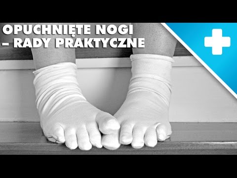 Guz dziecko na palcu jak kukurydza Koślawe zniekształcenie nóg u dziecka 2 lata