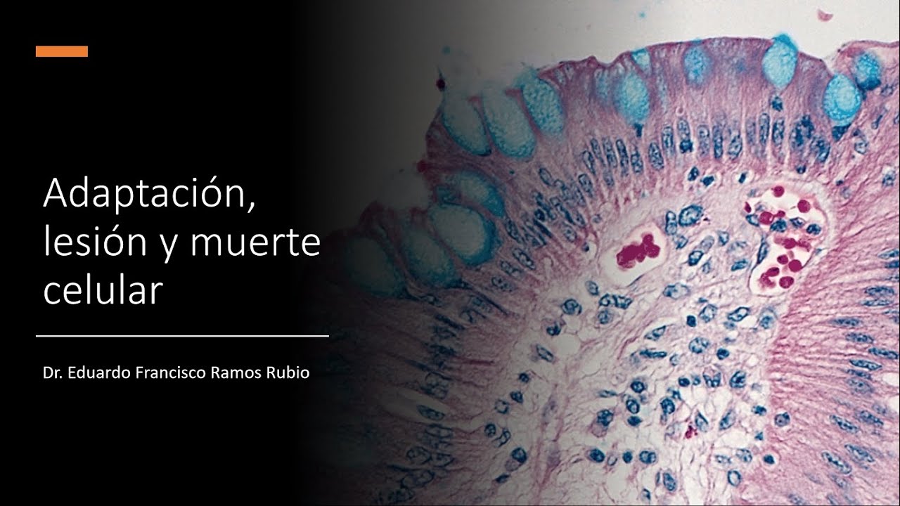 Adaptación, lesión y muerte celular