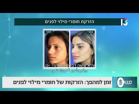 הזרקות של חומרי מילוי לפנים 