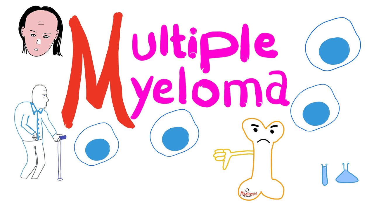 Multiple Myeloma - Malignancy of Plasma Cells - Bone marrow - Hematology & Oncology