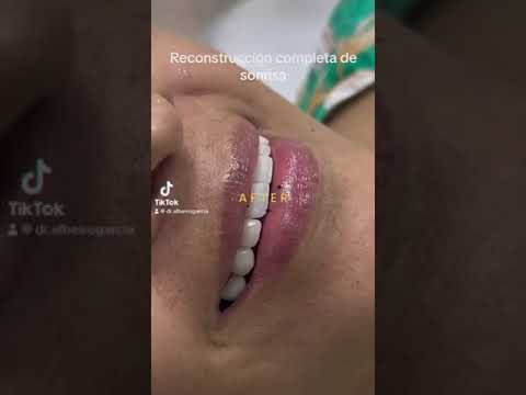 video SVnj_RIcV5o
