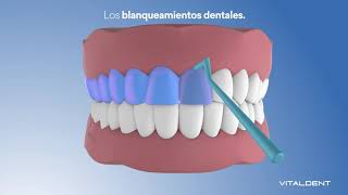 Vitaldent Estética Dental  anuncio