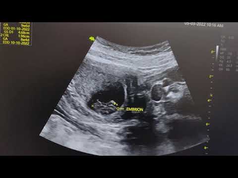 WHAT YOU SHOULD KNOW AT 9 WEEKS