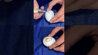 Frankel Facial Plastic Surgery