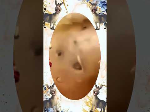 Blackheads Removal | Acne Treatment and Very Satisfying Satisfying Pimple pop #blackheads