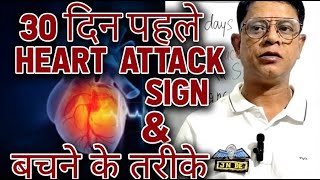 30 दिन पहले Heart Attack Ka Sign & बचने के तरीके। Doctor Speaks