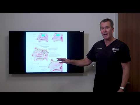 Non-Allergic Rhinitis & Vasomotor Rhinitis