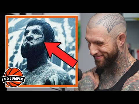 Alex Terrible Explains The Scar on his Face