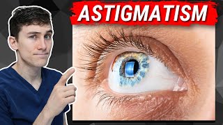 Astigmatism Explained - What You Need to Know!