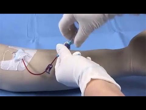 BD Nexiva™ Diffusics™ Closed IV Catheter Insertion Techniques