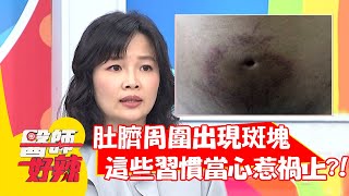 肚臍周圍出現斑塊，這些習慣當心惹禍上身？！【#醫師好辣】20210616 part2 EP1161 賈蔚 陳榮堅