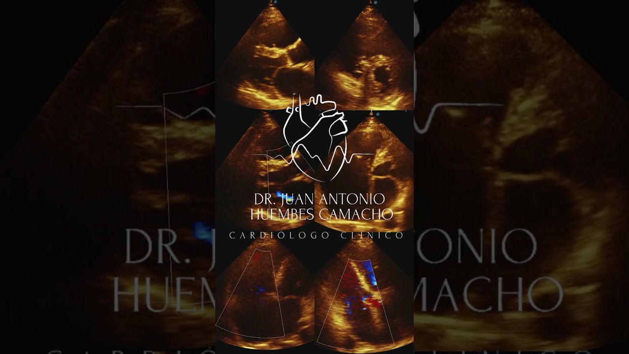 Juan Antonio Huembes Camacho-0