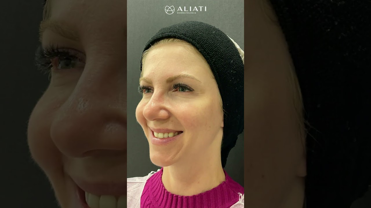 Ignacio Yanez Silva-10