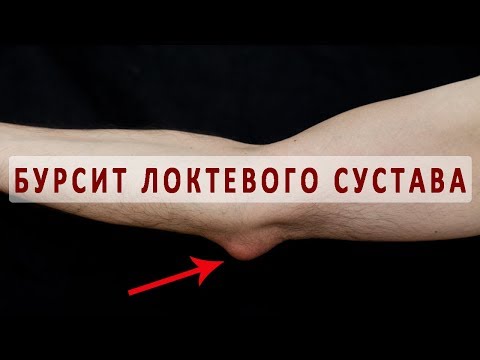 Соло для позвоночника ситтель шейный отдел Физические упражнения при остеохондрозе коленных суставов