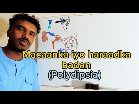 Xanuunka Macaanka iyo Haraadka badan(Polydipsia in DM )