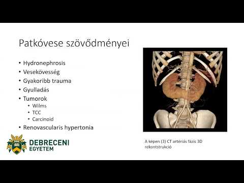 szívroham egészségügyi videók