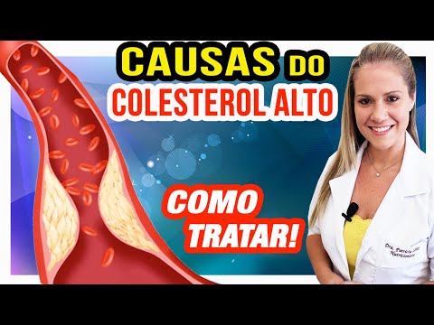 ISSO VAI TE DEIXAR COM COLESTEROL ALTO (Cuidados, Como Prevenir e Tratar!)