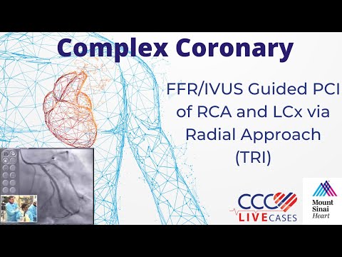 FFR/IVUS Guided PCI of RCA and LCx via Radial Approach (TRI) - May 17, 2011 Webcast Video