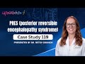 Case Study 119 PRES Posterior Reversible Encephalopathy Syndrome Explained By Dr Betsy Grunch