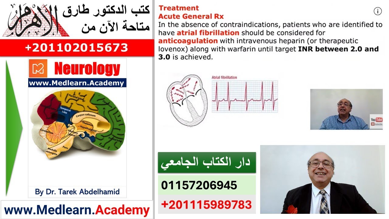Transient Ischemic Attacks TIA Lecture (3) #CME #internal_medicine #usmle #محاضرات_باطنة