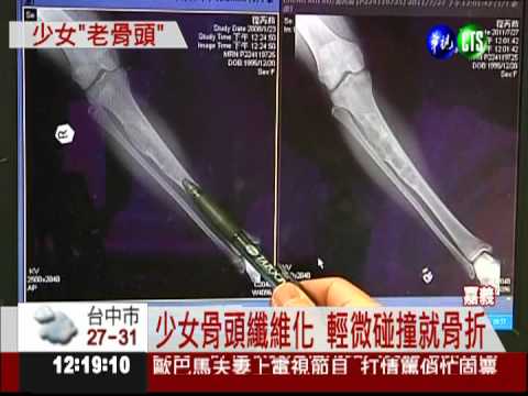 15歲女罹罕病 骨頭太脆一碰就斷