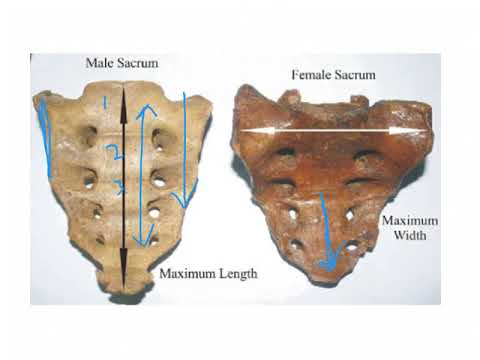 Differences between Male and Female Sacrum   ABDOMEN