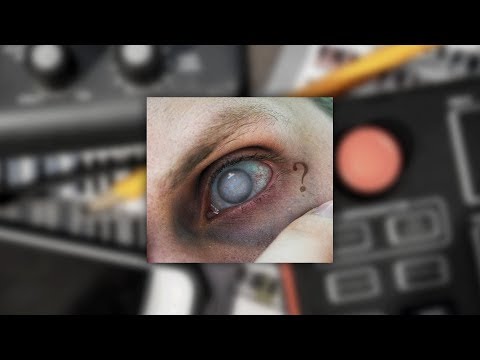 ??? [PRAWIE video] | ADIS. OSZALAŁ. 🐷🔥🐻 (prod. 27Corazones Beats)