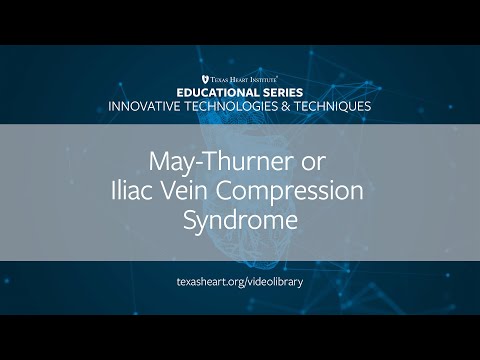 Episode 6 | May-Thurner or Iliac Vein Compression Syndrome