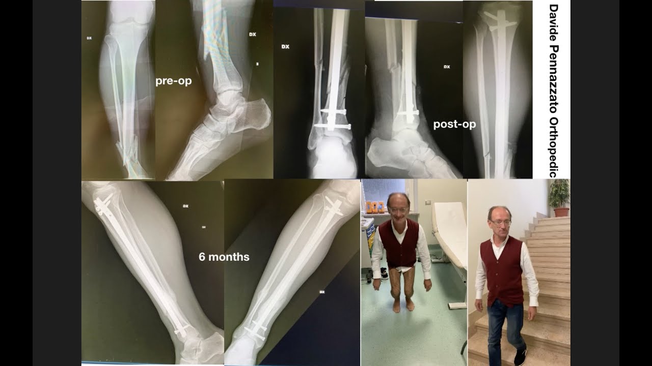 Davide Pennazzato-45