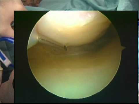 Agopuntura in Samara in osteocondrosi Giunti camera iperbarica