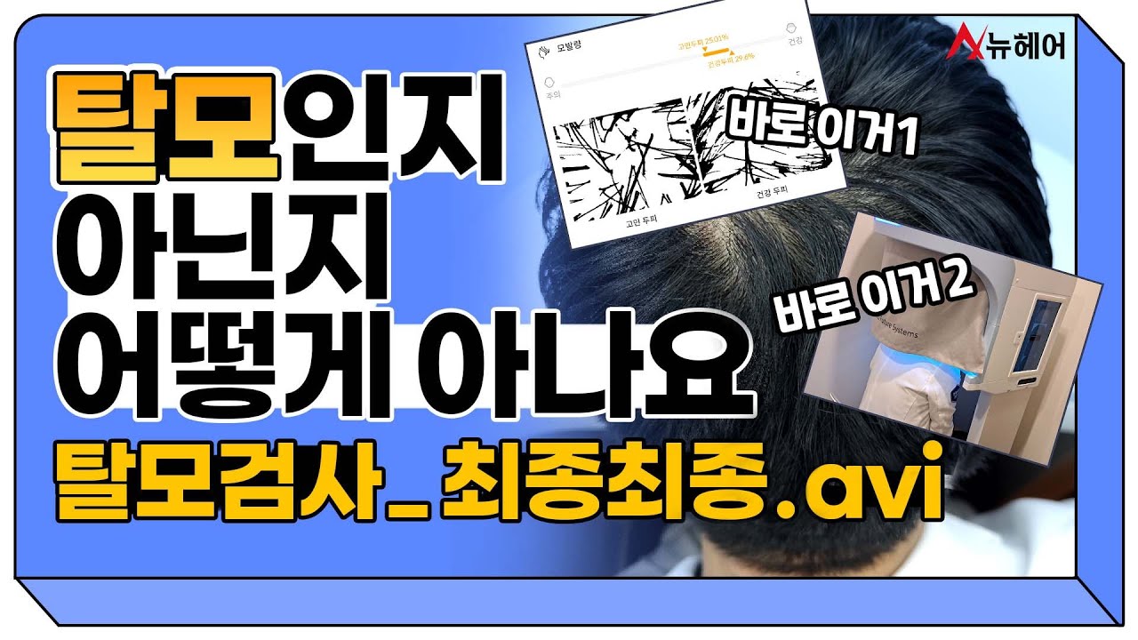 탈모 검사! 탈모인지 아닌지 확인법 알려드립니다ㅣ머리카락 인바디? 모바디!