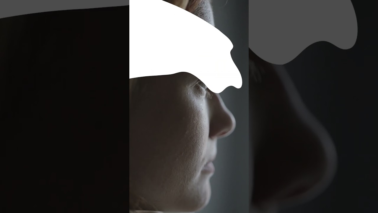 Symptoms Of Vitiligo | Vitiligo Treatment | Stem Cell Injection For Vitiligo | Skin Disease