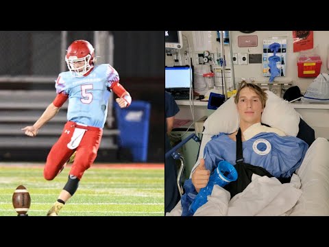 HOW I BROKE MY COLLARBONE!?!