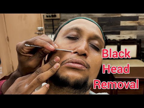 Black Head Removal Face Massage By Michael Barber