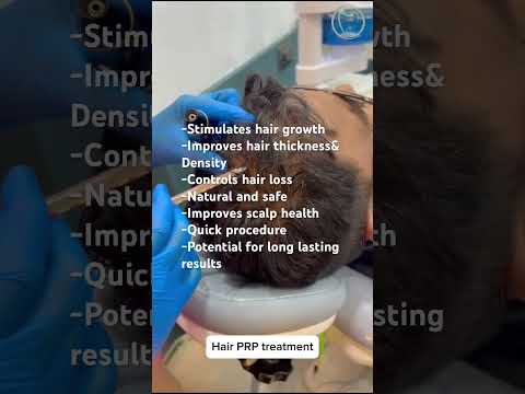 Hair PRP Treatment - Male pattern Baldness