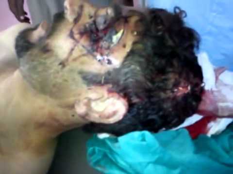 جثمان محمد حسن العيداوي في صوران في محافظة حماة