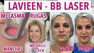 Laser Lavieen - Dói? BB Laser  Para que serve? Com Michelle Meleck
