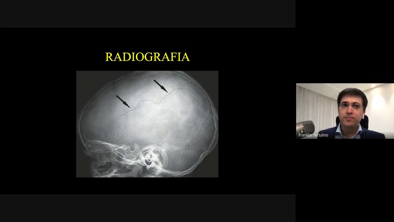 NEURORRADIOLOGIA - Introdução - PARTE 1