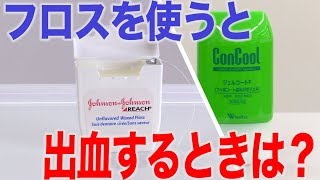 フロスで出血する人は？